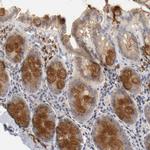 Renin Polyclonal Antibody