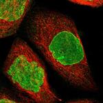 BRIP1 Polyclonal Antibody