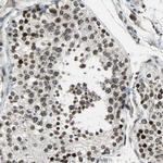 BRIP1 Antibody in Immunohistochemistry (Paraffin) (IHC (P))