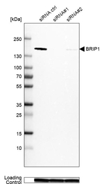 BRIP1 Antibody in Western Blot (WB)