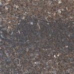 TEC Polyclonal Antibody