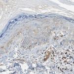 PEDF Antibody in Immunohistochemistry (Paraffin) (IHC (P))