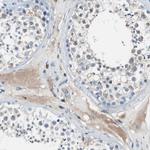 PEDF Antibody in Immunohistochemistry (Paraffin) (IHC (P))