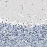 FHL2 Antibody in Immunohistochemistry (Paraffin) (IHC (P))