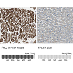 FHL2 Antibody in Immunohistochemistry (Paraffin) (IHC (P))