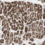 FHL2 Antibody in Immunohistochemistry (Paraffin) (IHC (P))