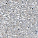 FHL2 Antibody in Immunohistochemistry (Paraffin) (IHC (P))