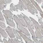 FHL2 Antibody in Immunohistochemistry (Paraffin) (IHC (P))