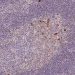 CD148 Polyclonal Antibody