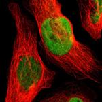 GATAD1 Polyclonal Antibody