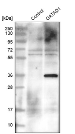 GATAD1 Antibody in Western Blot (WB)