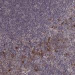 USP15 Polyclonal Antibody