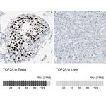 TOP2A Polyclonal Antibody