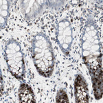 TOP2A Antibody in Immunohistochemistry (Paraffin) (IHC (P))