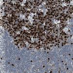 TOP2A Antibody in Immunohistochemistry (Paraffin) (IHC (P))