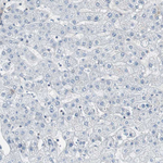 TOP2A Antibody in Immunohistochemistry (Paraffin) (IHC (P))