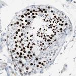 TOP2A Antibody in Immunohistochemistry (Paraffin) (IHC (P))