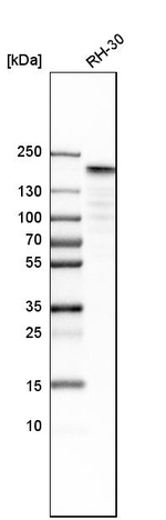 TOP2A Antibody in Western Blot (WB)