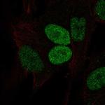 PRRX2 Polyclonal Antibody