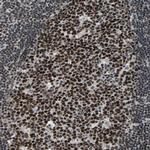 RAP1 Antibody in Immunohistochemistry (Paraffin) (IHC (P))