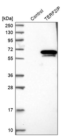 RAP1 Antibody in Western Blot (WB)
