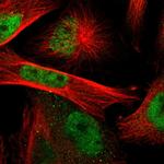 RAD9 Polyclonal Antibody