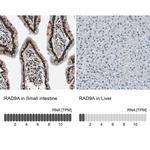 RAD9 Antibody in Immunohistochemistry (Paraffin) (IHC (P))