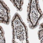 RAD9 Antibody in Immunohistochemistry (Paraffin) (IHC (P))