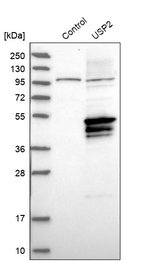 USP2 Antibody in Western Blot (WB)