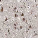 Sortilin Antibody in Immunohistochemistry (Paraffin) (IHC (P))