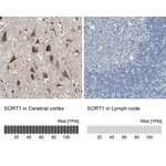 Sortilin Polyclonal Antibody