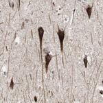 Sortilin Antibody in Immunohistochemistry (Paraffin) (IHC (P))