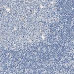 Sortilin Antibody in Immunohistochemistry (Paraffin) (IHC (P))