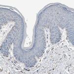 Sortilin Antibody in Immunohistochemistry (Paraffin) (IHC (P))