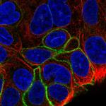 GPR160 Polyclonal Antibody