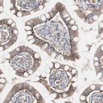 GPR160 Antibody in Immunohistochemistry (Paraffin) (IHC (P))