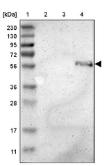 ZMPSTE24 Antibody in Western Blot (WB)