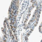 K-cadherin Antibody in Immunohistochemistry (Paraffin) (IHC (P))