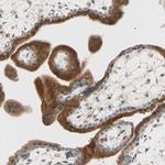 K-cadherin Antibody in Immunohistochemistry (Paraffin) (IHC (P))