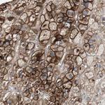 ALPL Antibody in Immunohistochemistry (Paraffin) (IHC (P))