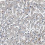 ALPL Antibody in Immunohistochemistry (Paraffin) (IHC (P))