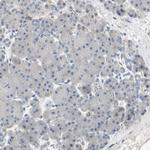 ALPL Antibody in Immunohistochemistry (Paraffin) (IHC (P))