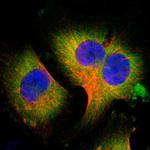 WISP1 Polyclonal Antibody