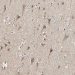 USP2 Antibody in Immunohistochemistry (Paraffin) (IHC (P))