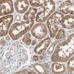 USP2 Antibody in Immunohistochemistry (Paraffin) (IHC (P))
