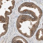 USP2 Antibody in Immunohistochemistry (Paraffin) (IHC (P))