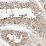 USP2 Antibody in Immunohistochemistry (Paraffin) (IHC (P))