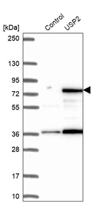 USP2 Antibody in Western Blot (WB)