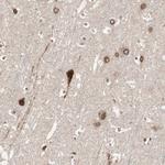 CAMK1D Antibody in Immunohistochemistry (Paraffin) (IHC (P))