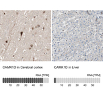 CAMK1D Antibody in Immunohistochemistry (Paraffin) (IHC (P))